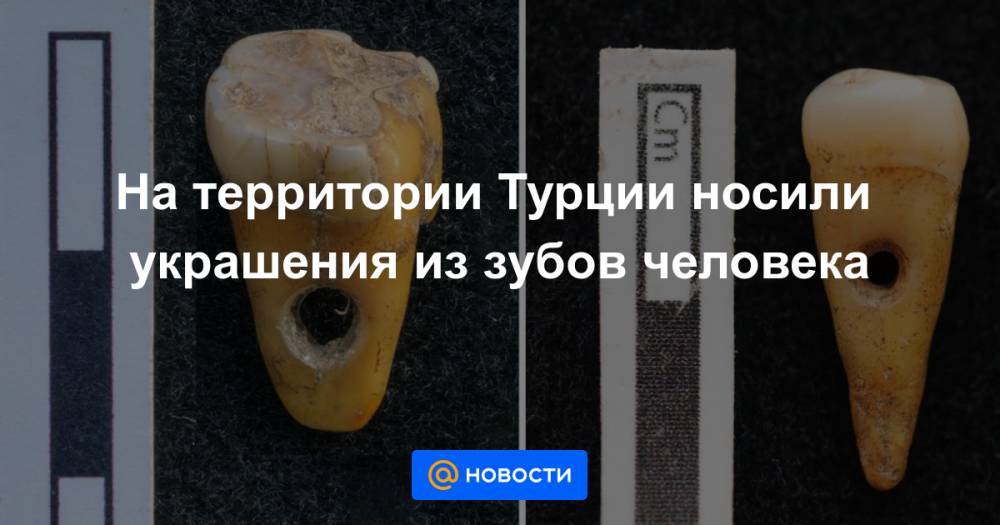 На территории Турции носили украшения из зубов человека - news.mail.ru