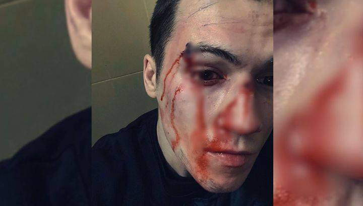 Дмитрий Кузнецов - Бойца ММА избили в Москве на глазах его девушки - vesti.ru - Москва
