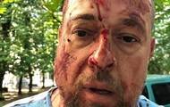 В Харькове избили активиста Нацкорпуса. 18+ - korrespondent.net - Харьков - Каменск - Харьков - Нападение