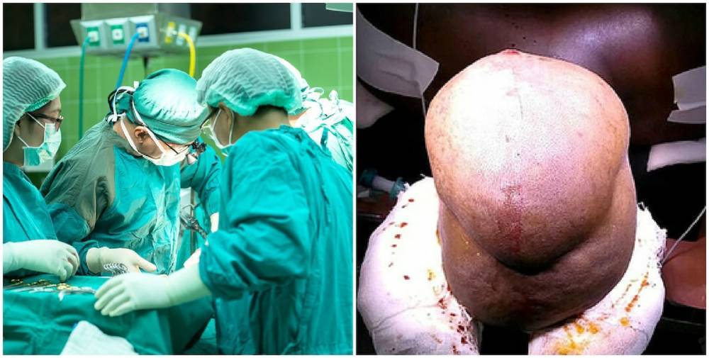 Мужчина вырастил на голове самую большую в мире опухоль - nur.kz - Индия - штат Тамилнад
