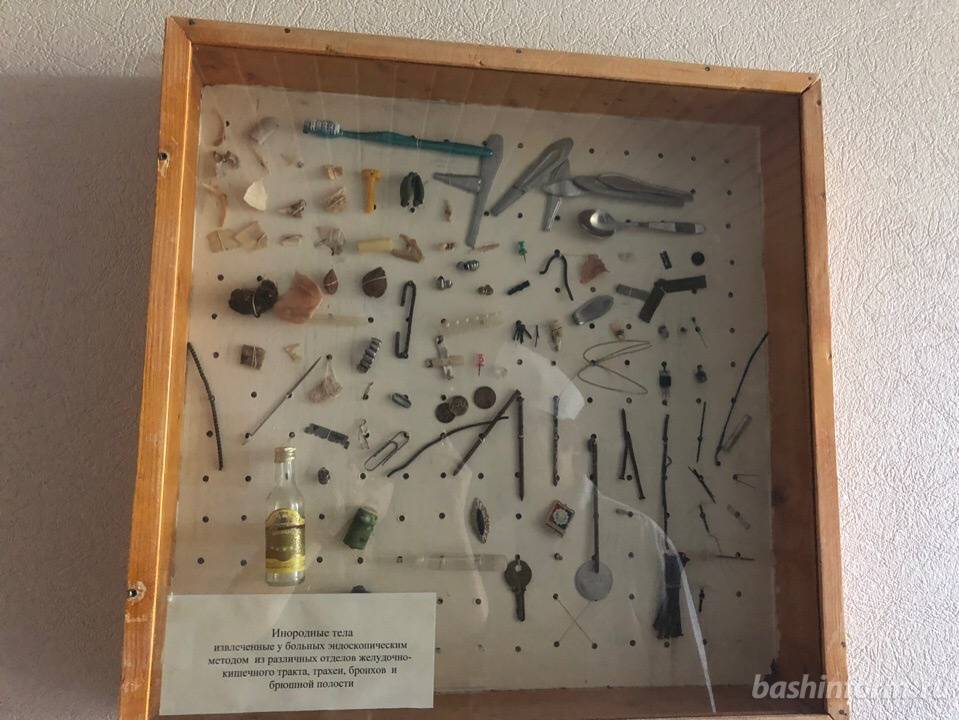 В Уфе врачи рассказали, что извлекают из ЖКТ, трахеи, бронхов и брюшной полости - bashinform.ru - Башкирия - Уфа
