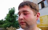 Появились подробности нападения на журналистов в Прилуках - korrespondent.net - Черниговская обл. - Нападение
