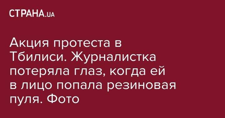 Акция протеста в Тбилиси. Журналистка потеряла глаз, когда ей в лицо попала резиновая пуля. Фото - strana.ua - Россия - Тбилиси
