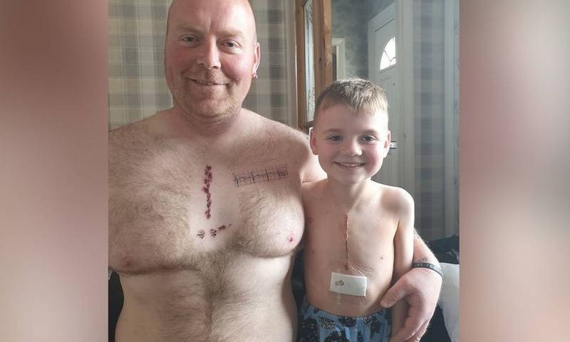 Папа нашёл милый способ, как поддержать 6-летнего сына после операции на сердце - bloknot.ru - Великобритания