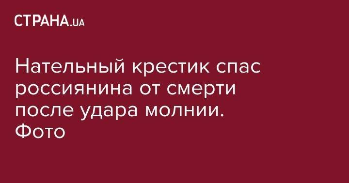Нательный крестик спас россиянина от смерти после удара молнии. Фото - strana.ua - Россия - респ. Алтай - Пенза