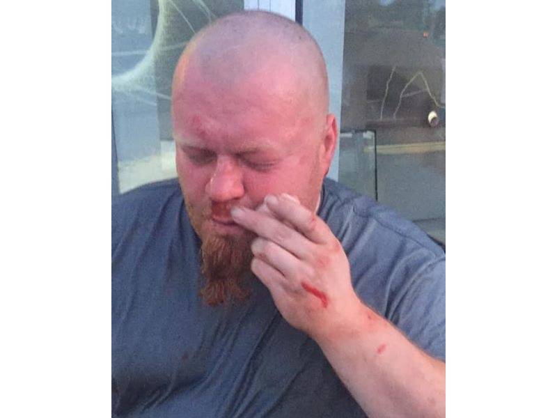 Сергей Зайцев - «За то, что снимал правду»: в Харькове избили журналиста во время потасовки между нацистами и карателями - news-front.info