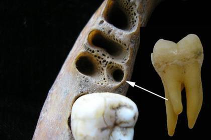 Доказано скрещивание людей с другим видом - newtvnews.ru - респ. Алтай - Нью-Йорк