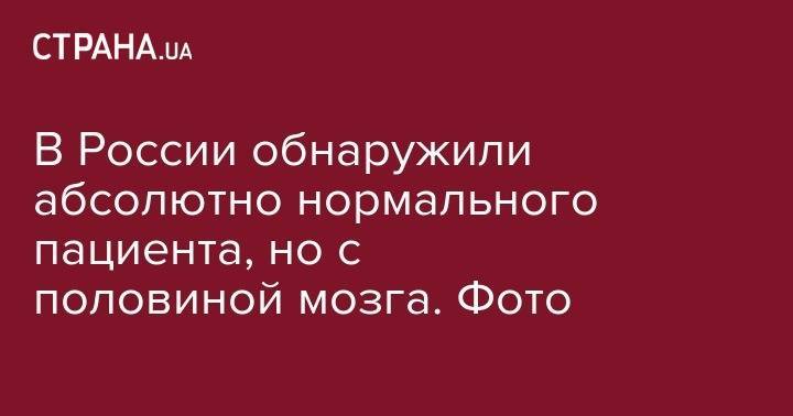 Николай Валуев - В России обнаружили абсолютно нормального пациента, но с половиной мозга. Фото - strana.ua - Россия