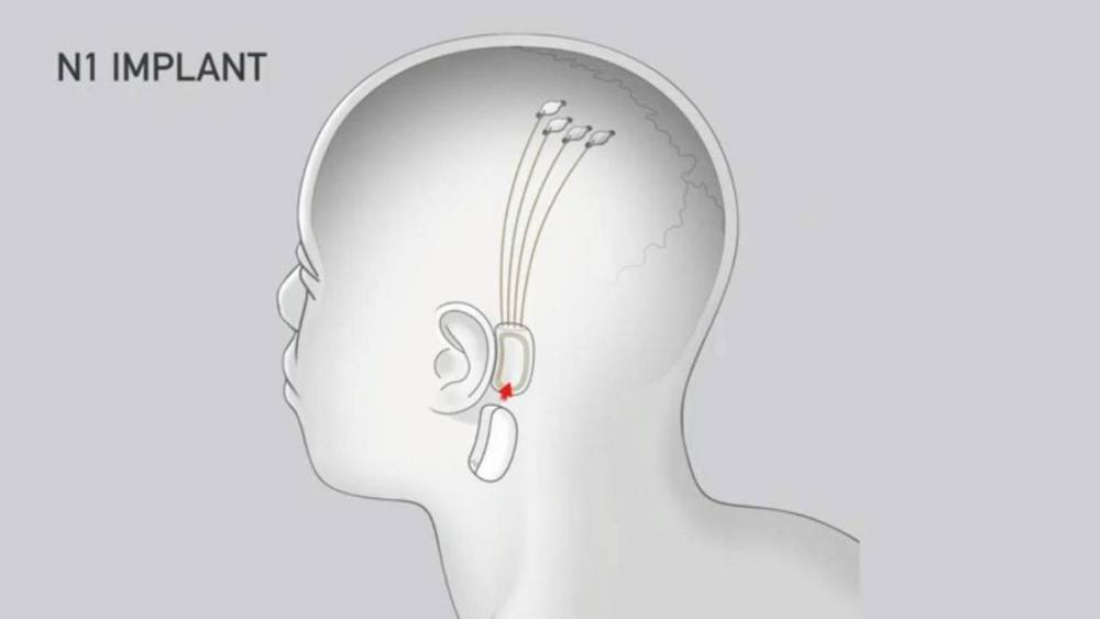Илон Маск - Илон Маск представит проект Neurolink - fainaidea.com