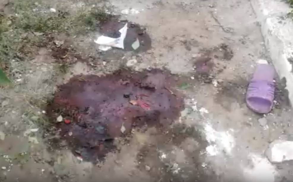 Кровь на руках Зеленского: В Донецке скончалась женщина, получившая ранения под обстрелом ВСУ - news-front.info - Донецк