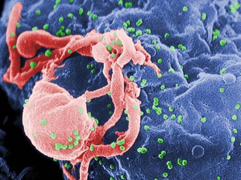 Геном вируса иммунодефицита человека выделен из образцов ткани полувековой давности - polit.ru - США - Париж - Канада - Конго - Киншаса