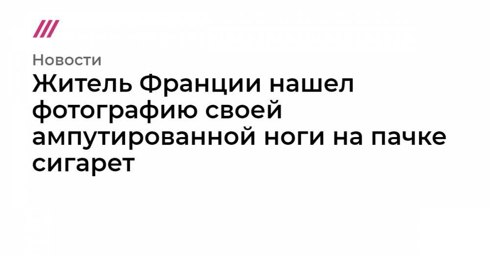 Житель Франции нашел фотографию своей ампутированной ноги на пачке сигарет - tvrain.ru - Люксембург - Албания