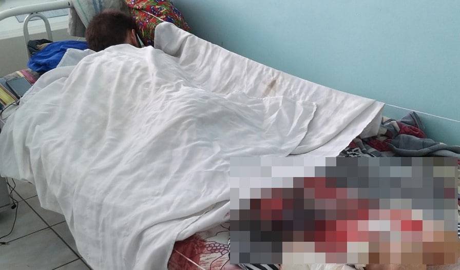 "Вспыхнули заживо": страшные ожоги получил парень из Актобе, спасая человека (фото) - nur.kz - Актобе