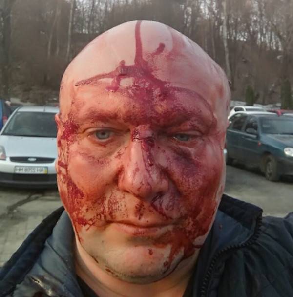 Третье покушение на адвоката Святогора: убийц на жертву, похоже, навела полиция - argumentua.com - Украина - Киев