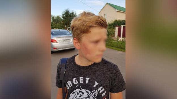 «От ударов упал на колени». Под Воронежем бывший полицейский избил 12-летнего мальчика – Новости Воронежа и Воронежской области – Вести Воронеж - vestivrn.ru - Воронеж