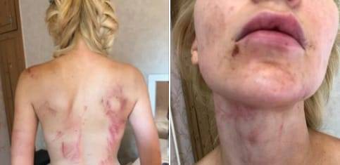 Певица заявила об избиении мужем: в полиции Алматы завели уголовное дело - nur.kz - Казахстан - Алма-Ата