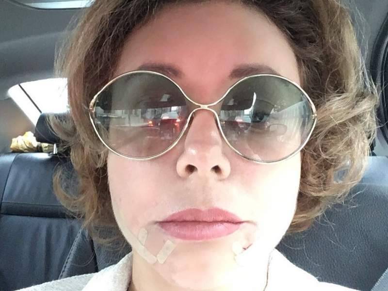 Божена Рынска - "Лицо поехало": 44-летняя Божена Рынска перекроила себя ради селфи - dayonline.ru - Москва - Рынск
