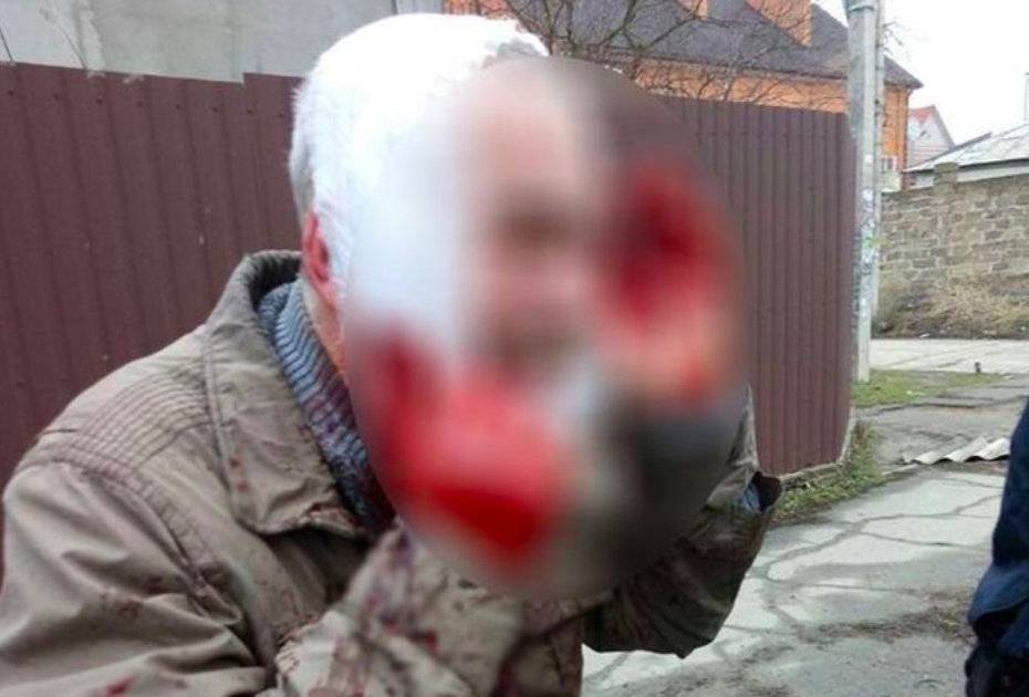 Смолянин полоснул друга ножом по горлу, потому что ему так захотелось - readovka.ru - район Смоленский