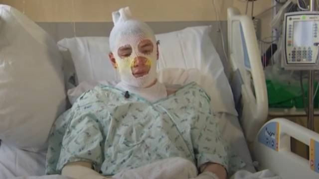 Юноша получил страшные ожоги, спасая из пылающего дома 8-летнюю племянницу. РЕН ТВ - ren.tv - штат Вашингтон