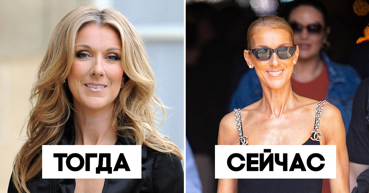 Алена Миро - Селин Дион - 51-летняя Селин Дион выряжается так, что у прохожих глаза на лоб лезут - boom.ms - Париж
