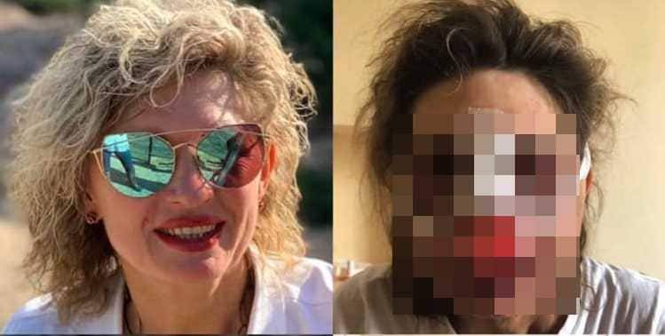 Известного психолога жестоко избили кастетом возле собственного дома в Алматы - nur.kz - Алма-Ата