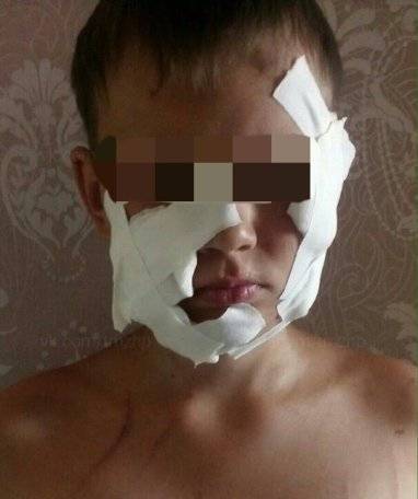 Анастасий Голичев - «Наложили швы на лицо под наркозом»: еще одно нападение собаки на ребенка произошло в Башкирии - gorobzor.ru - Башкирия