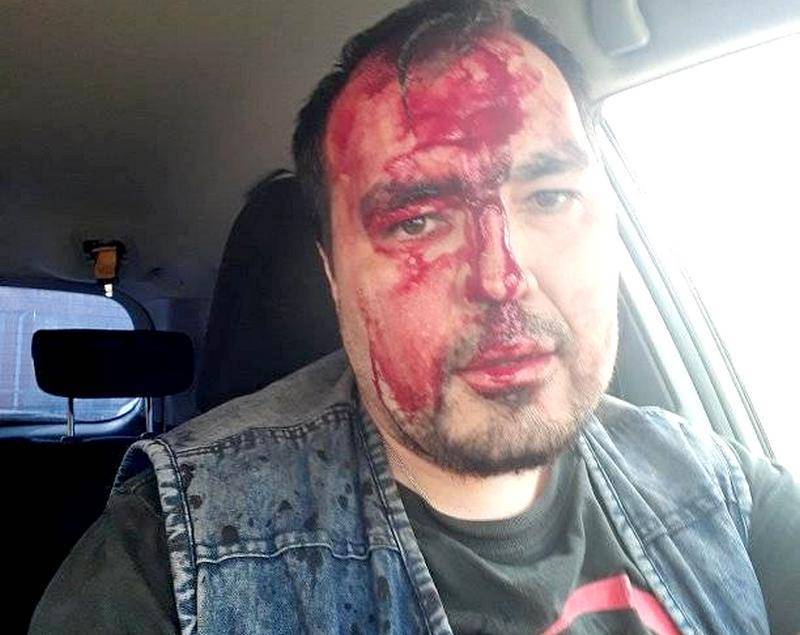 На выборах в улан-удэнский горсовет пролилась первая кровь - infpol.ru - респ.Бурятия
