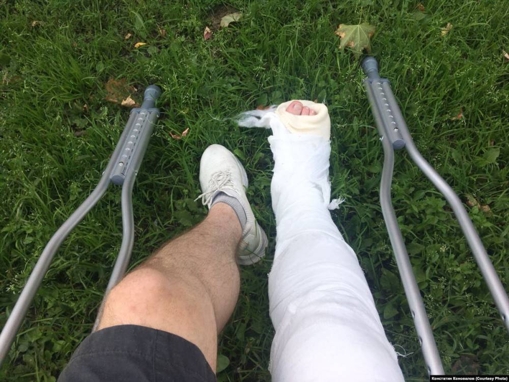 Константин Коновалов - СК одобрил действия полицейских, сломавших ногу дизайнеру - svoboda.org - Россия