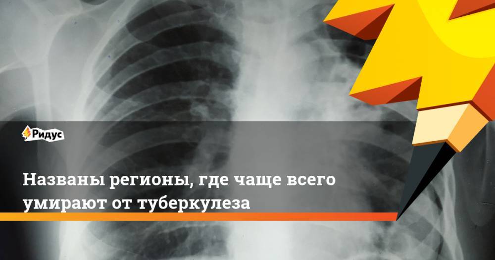 Названы регионы, где чаще всего умирают от туберкулеза. Ридус - ridus.ru - Россия - Белгородская обл. - Рязанская обл. - окр.Ненецкий - респ. Карачаево-Черкесия