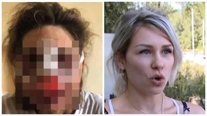 "Была конкретная задача – изувечить лицо": дочь избитой алматинки о нападении - nur.kz - Алма-Ата