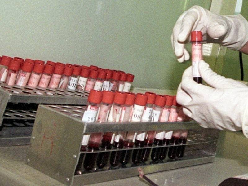 Учёные открыли механизм, убивающий СПИД - news.ru