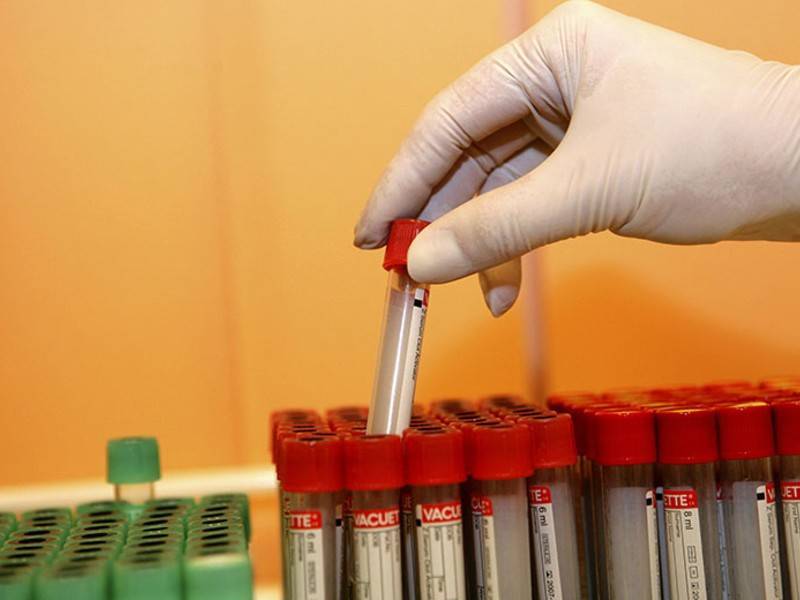 Учёные нашли «убежище» ВИЧ в организме пациента во время терапии - news.ru