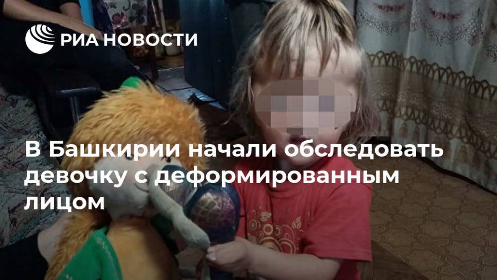 В Башкирии начали обследовать девочку с деформированным лицом - ria.ru - Башкирия - Уфа
