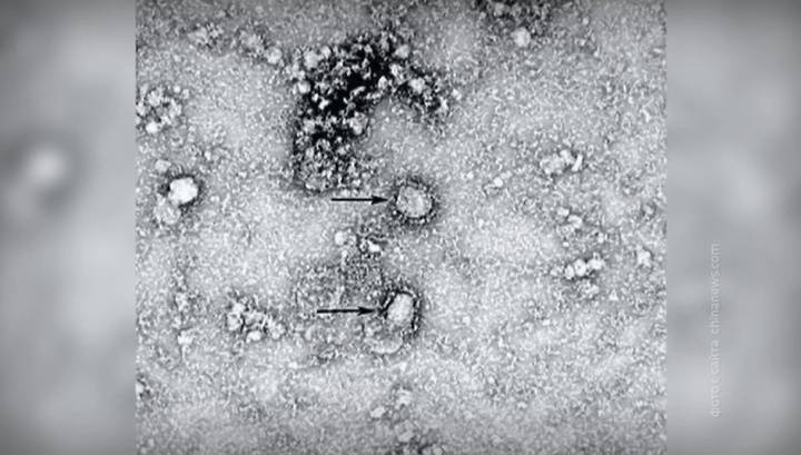 Двухлетний ребенок стал самым молодым из заболевших новым коронавирусом - vesti.ru - Китай - Шанхай - Ухань - район Гуанси-Чжуанский
