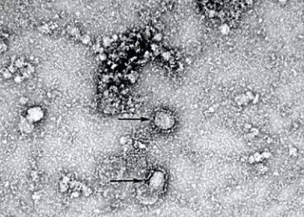 Китайские ученые установили источник коронавируса - nakanune.ru - Китай - Ухань