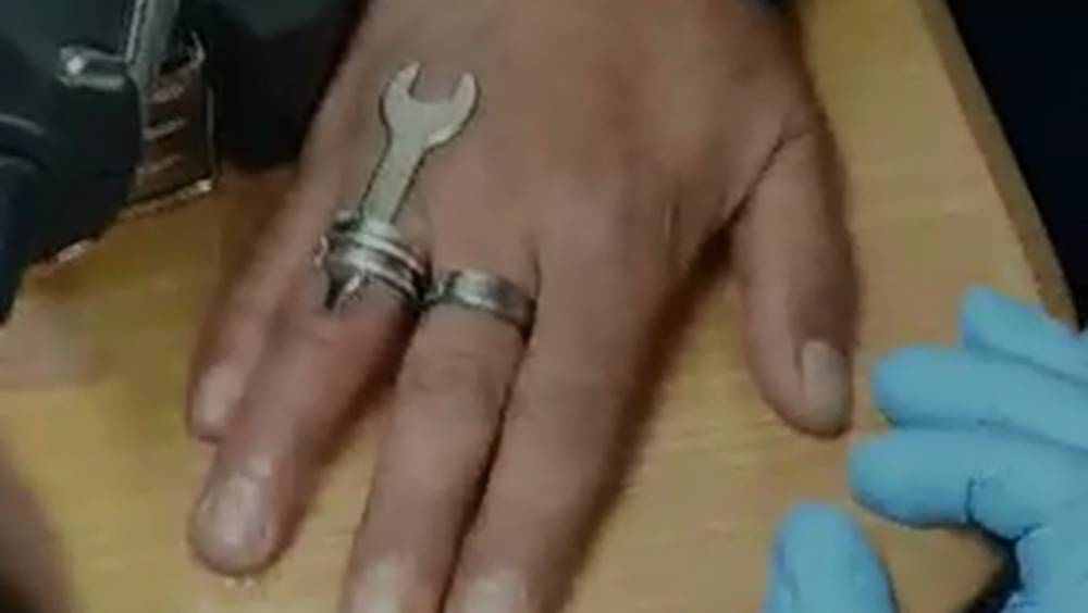 Видео: жителя Беэр-Шевы спасли от застрявшего на пальце кольца специнструментом - vesty.co.il - Беэр-Шевы
