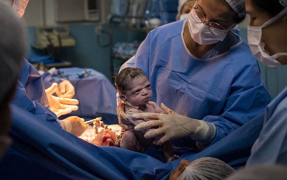 Выражение лица только что родившейся девочки стало мемом в Сети - gazeta.a42.ru - Рио-Де-Жанейро