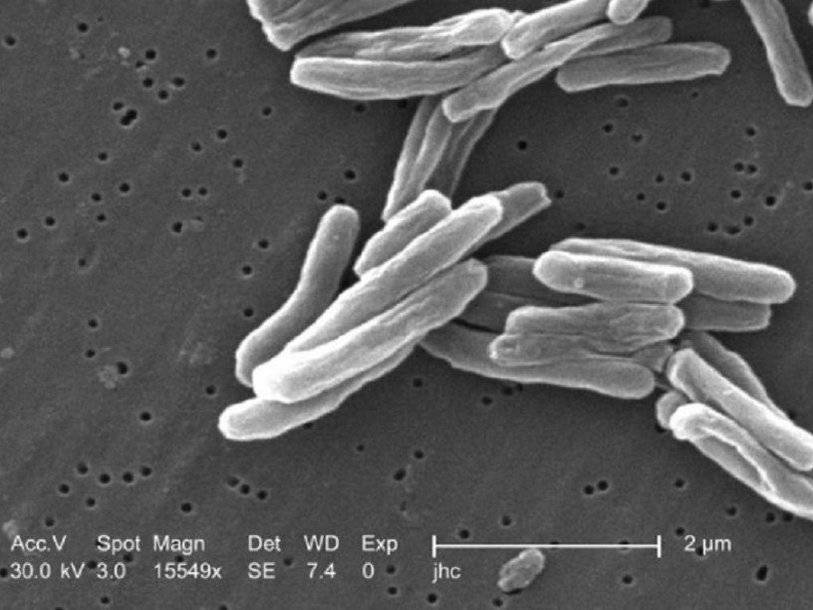 Новый метод позволит диагностировать туберкулез по выдыхаемому воздуху - polit.ru - Россия