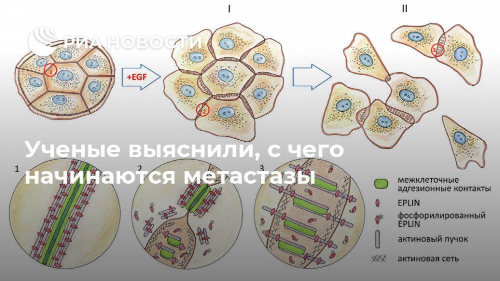 Ученые выяснили, с чего начинаются метастазы - ria.ru - Москва