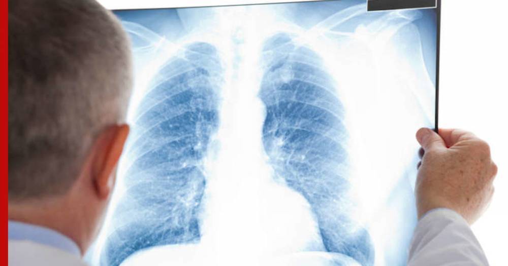 Медики посоветовали некурящим людям провериться на рак легких - profile.ru - Лондон - Великобритания