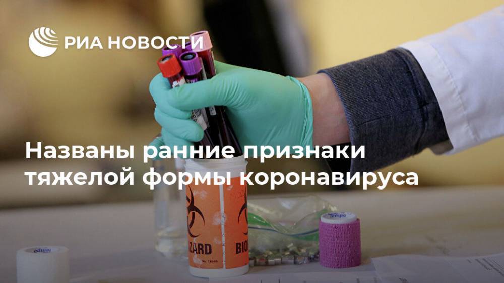 Названы ранние признаки тяжелой формы коронавируса - ria.ru - Москва - Нью-Йорк - Нью-Йорк