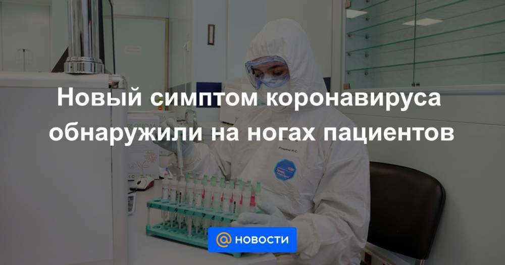 Новый симптом коронавируса обнаружили на ногах пациентов - news.mail.ru - Испания