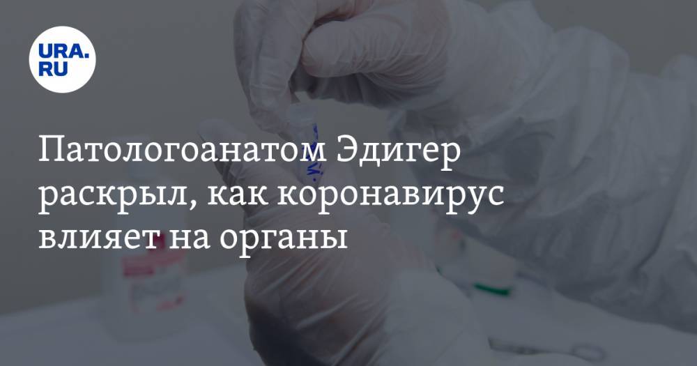 Александр Эдигер - Патологоанатом Эдигер раскрыл, как коронавирус влияет на органы - ura.news - Китай - Царьград