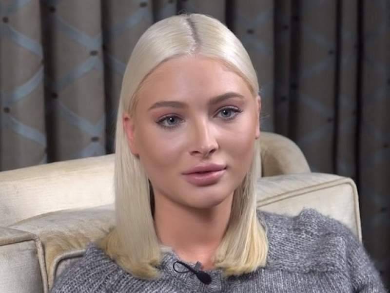 Алена Шишкова - "Повторяет судьбу Началовой": у Алены Шишковой заподозрили страшный диагноз - dayonline.ru