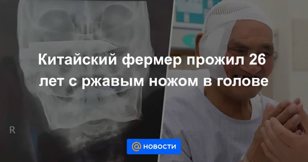 Китайский фермер прожил 26 лет с ржавым ножом в голове - news.mail.ru - Китай