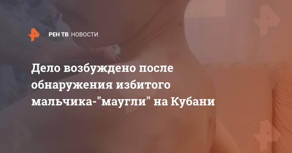 Дело возбуждено после обнаружения избитого мальчика-"маугли" на Кубани - ren.tv - Россия - Краснодарский край - Новороссийск