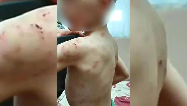 Потоп в квартире помог найти шестилетнего мальчика-маугли в Новороссийске - vesti.ru - Новороссийск