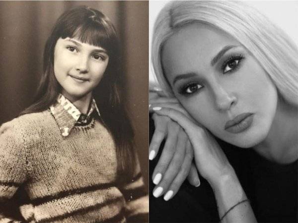 Лера Кудрявцева - Чистая как ребенок. Кудрявцева задумалась об «обнулении» пластики - vestirossii.com