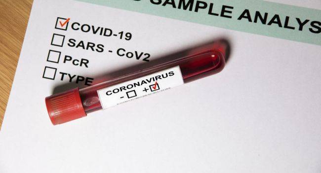 Литва стала лидером ЕС по количеству проводимых тестов на Covid-19 - eadaily.com - Италия - Эстония - Литва - Португалия