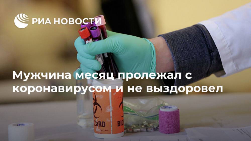 Мужчина месяц пролежал с коронавирусом и не выздоровел - ria.ru - Москва - Австралия - Лондон - Великобритания
